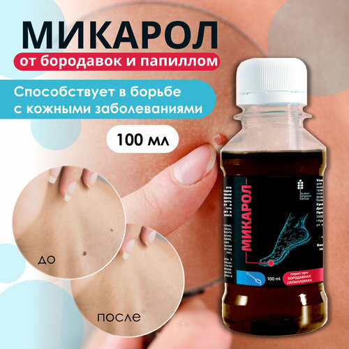 ���� ������� ����� �� ��������� � ��������, ������ �� 590 ���